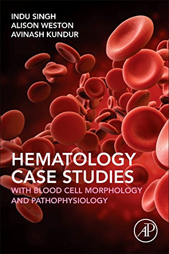 Haematology case study assignment image